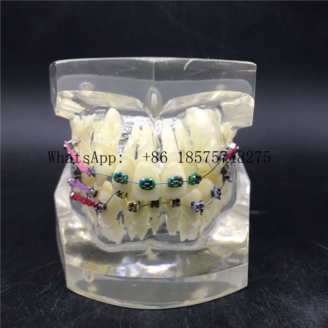 Malocclusion Model with Brackets Chain Wire Dental Tooth Model