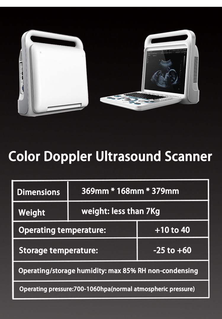 My-A027b Portable Echocardiography Machine Equipment 3D/4D Full Digital Color Doppler Ultrasound Scanner Price