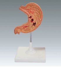 Xy-3329-4 Human Stomach Model (teaching model)