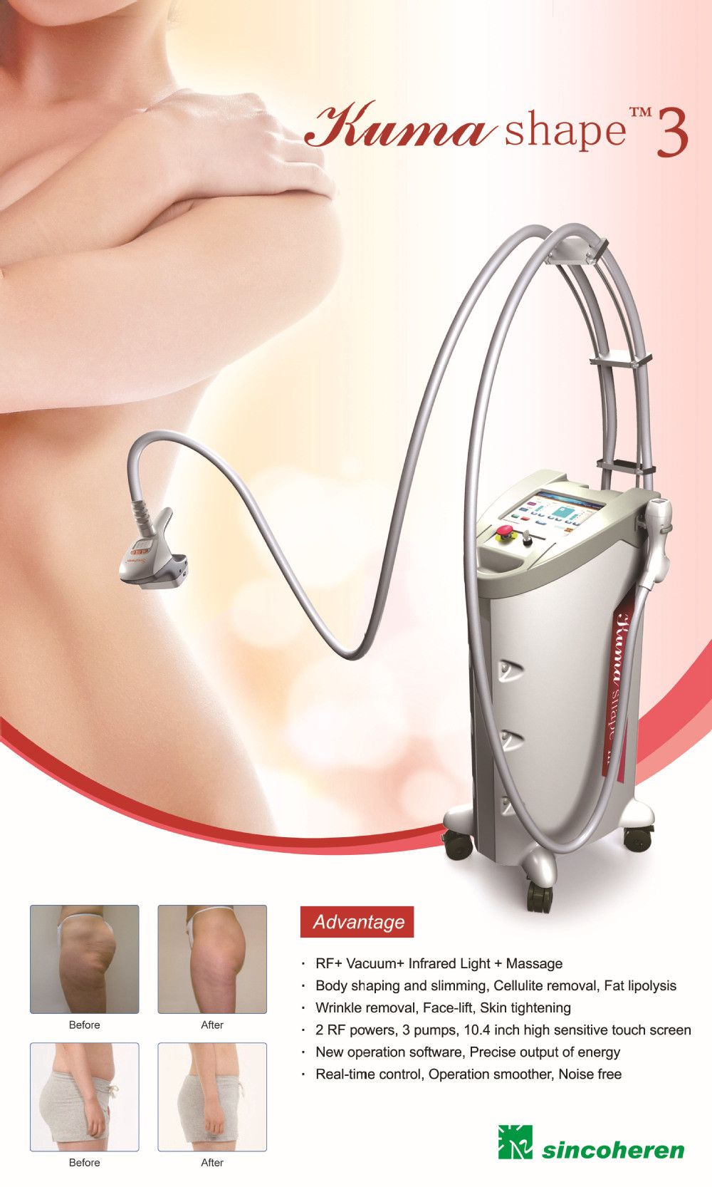 Vacuum Suction + Automatic Roller + Bipolar RF, Infrared Light Slimming Machine.