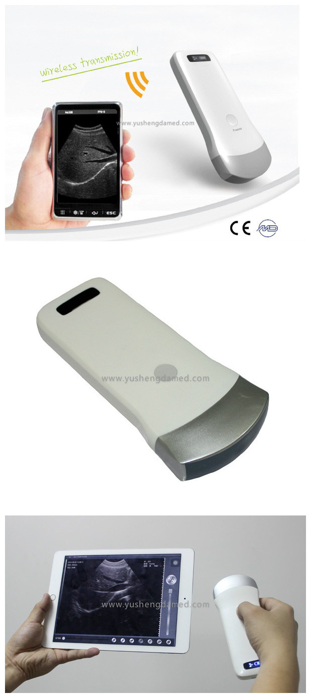 Ce FDA New Developed 4D Wireless Ultrasound Machine Bladder Probe