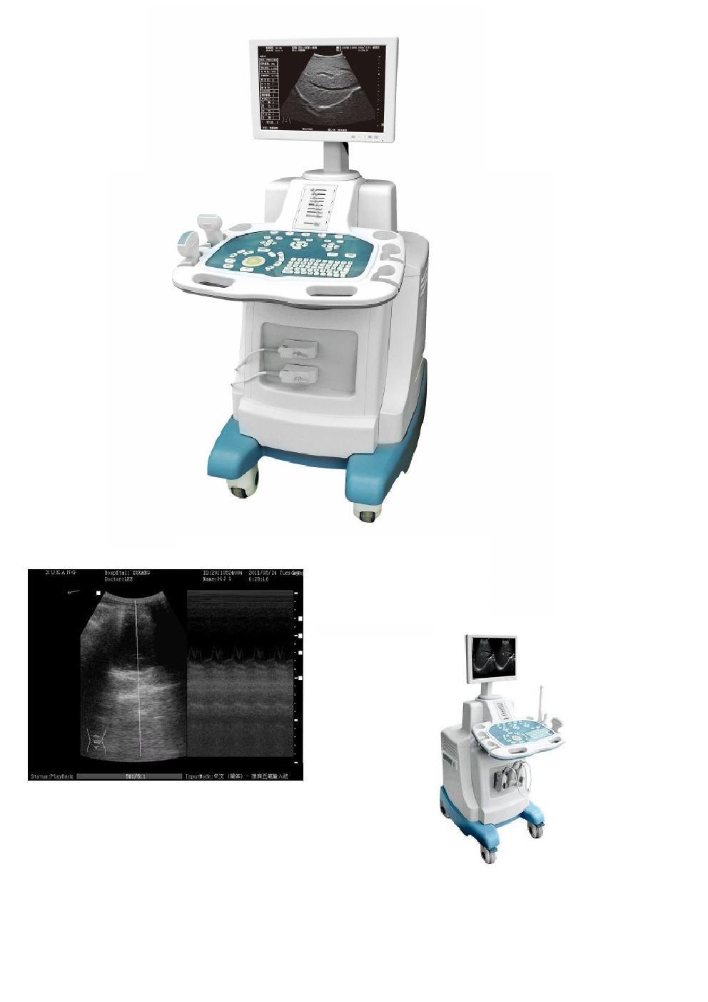 B Model Ultrasound Scanner with High Quality (QDMH-MQ-001A)