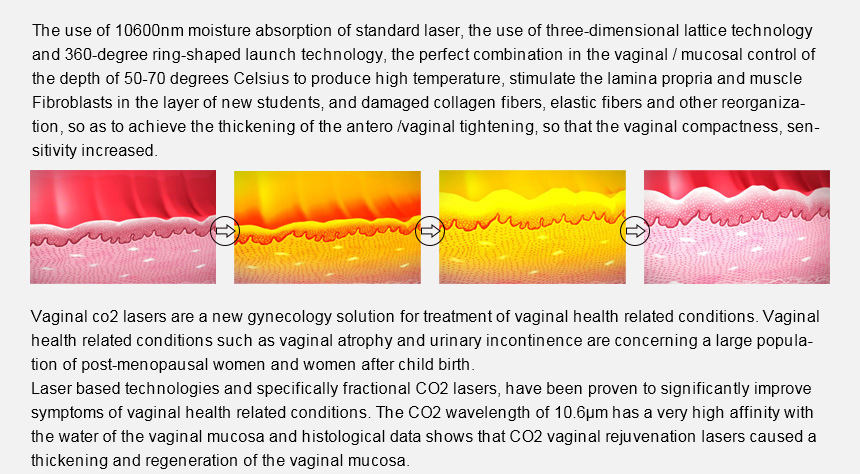 CO2 Fractional Laser Vaginal Tightening Skin Rejuvenation Machine