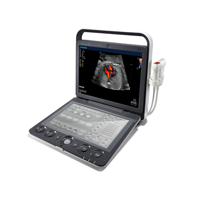 FDA Approved Color Doppler 4D Ultrasound Laptop at Low Cost