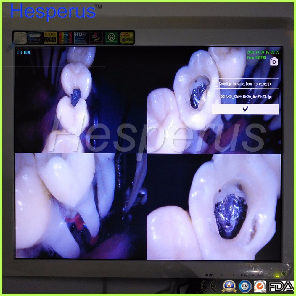 Dental Equipment Pip Oral Camera Intraoral Camera USB Intraoral Camera with Monitor Asin