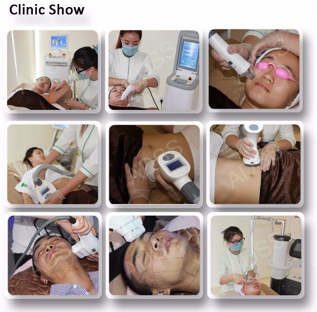 Portable and Cheapest Beauty Device IPL Shr Laser