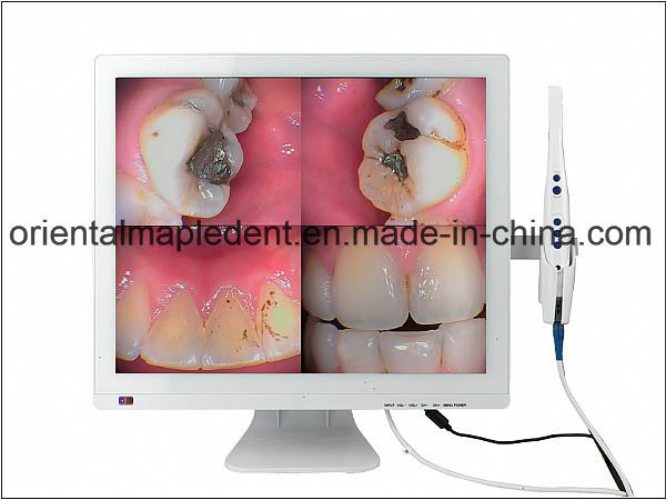 CE Approved Dental Intraoral Camera with 19 Inch LED Monitor