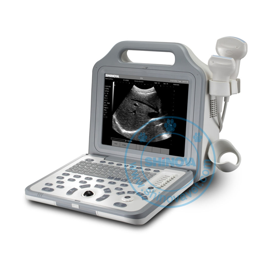 Portable Full Digital Ultrasound System (SonoScan R2V)