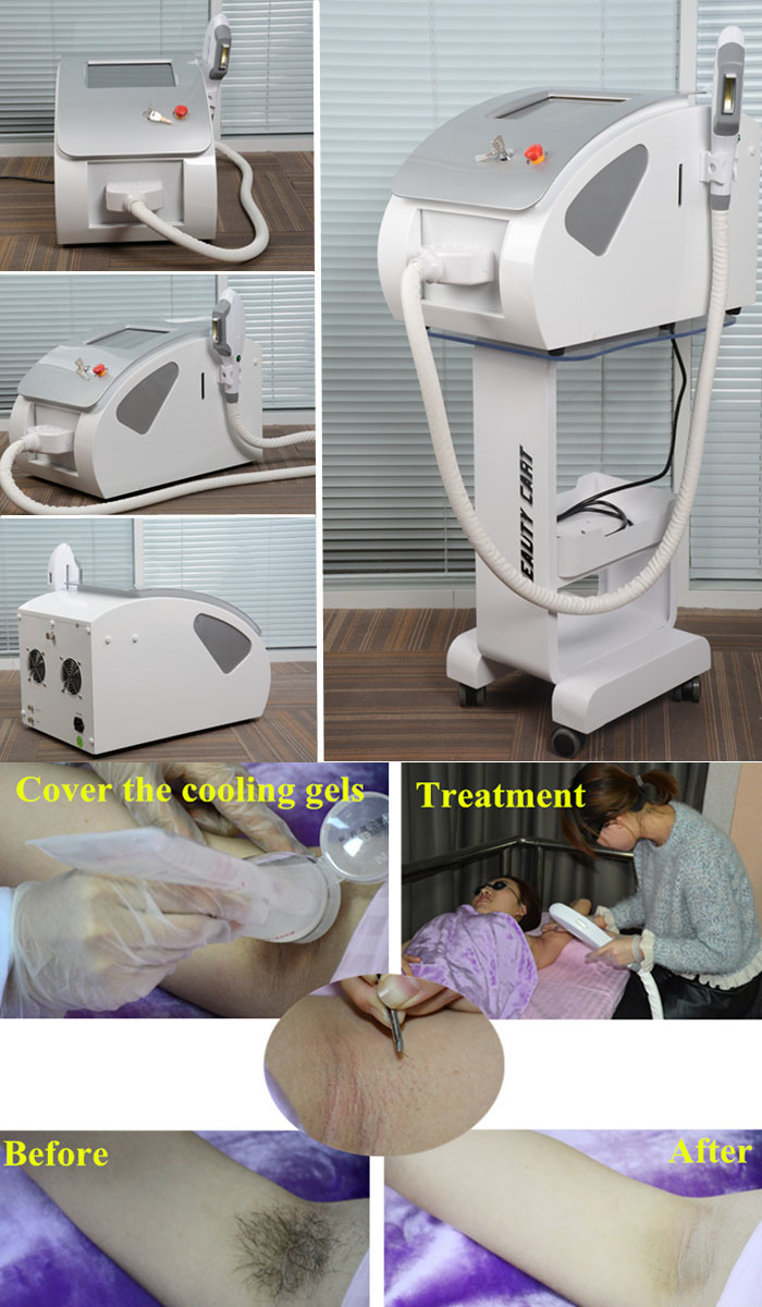 Portable Diode Laser Hair Removal Machine IPL E Light Hair Removal