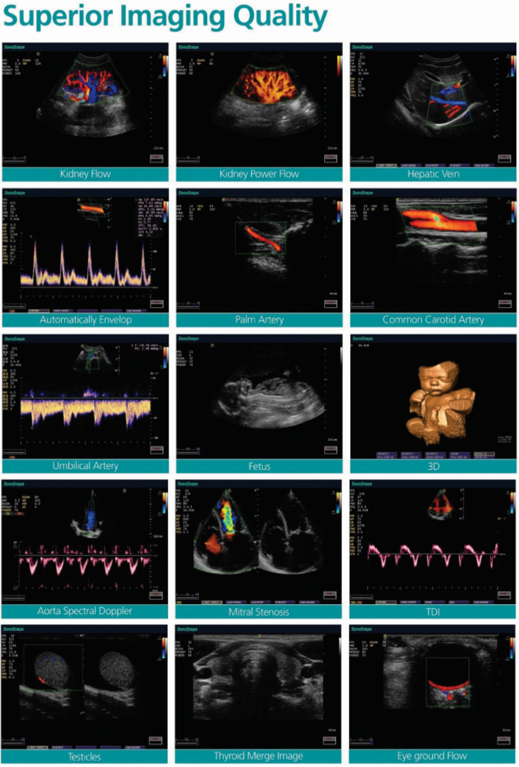 BS-S20 Portable Color Doppler Fetal Ultrasound with High Quality