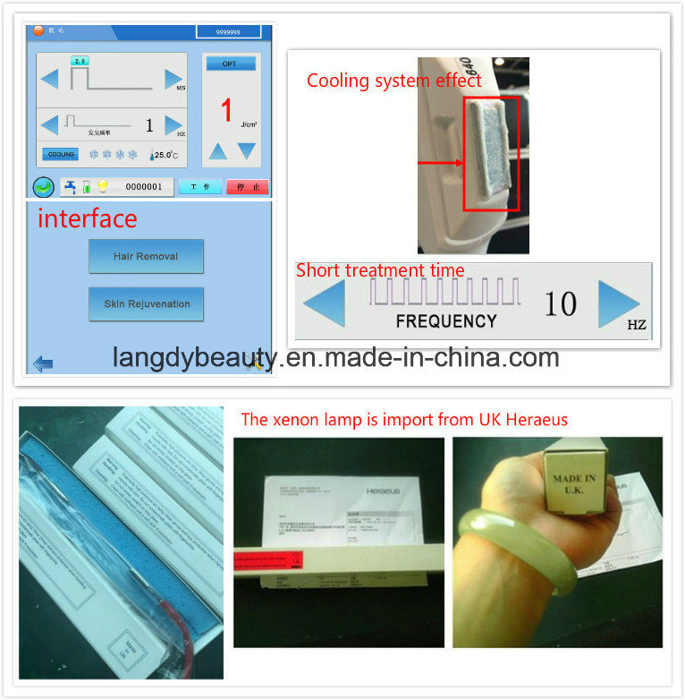 E-Light IPL RF ND YAG Multifunction Machine