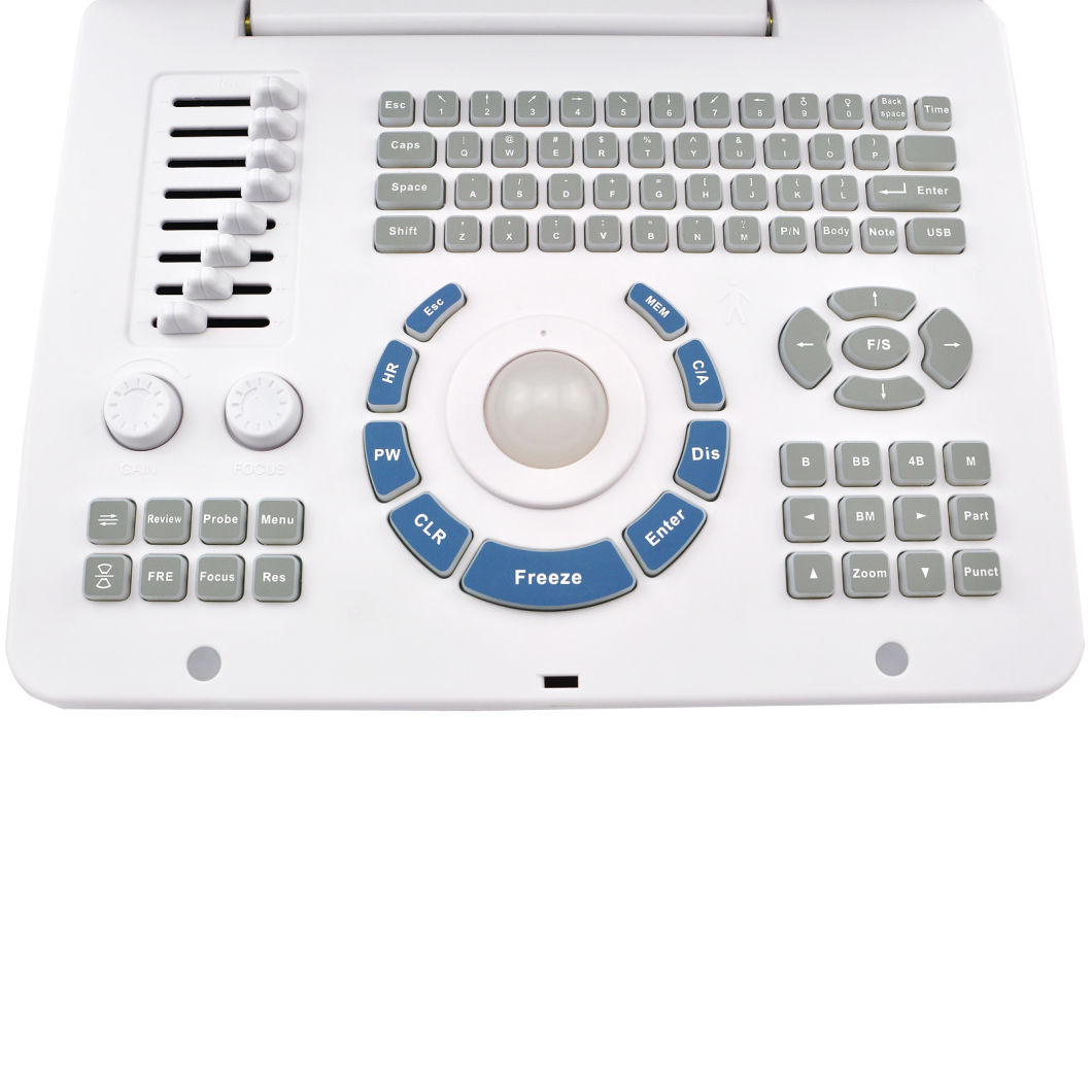 Good Price Diagnostic Ultrasonic System Ultrasound Scanner -- Alisa