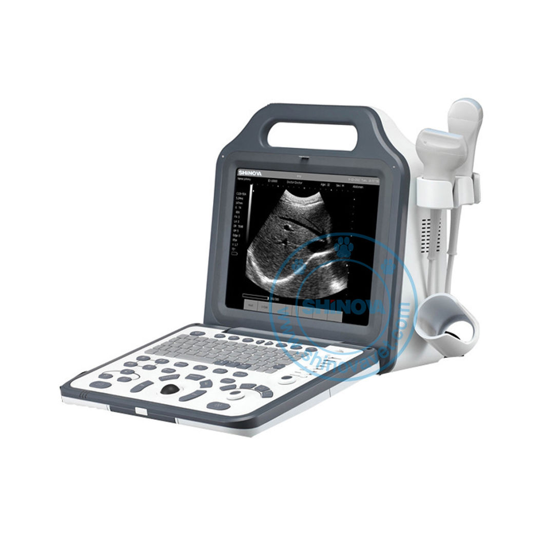 12-Inch Portable Veterinary Ultrasound Scanner (SonoScan R5V)