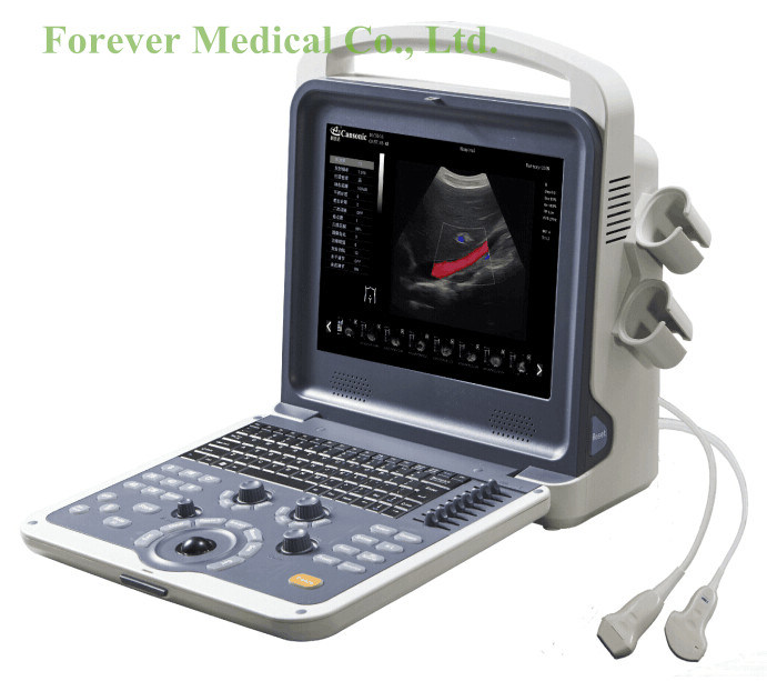 Manufacturer Laptop Color Doppler Ultrasound Scanner with Cw Mode (YJ-U60PLUS)