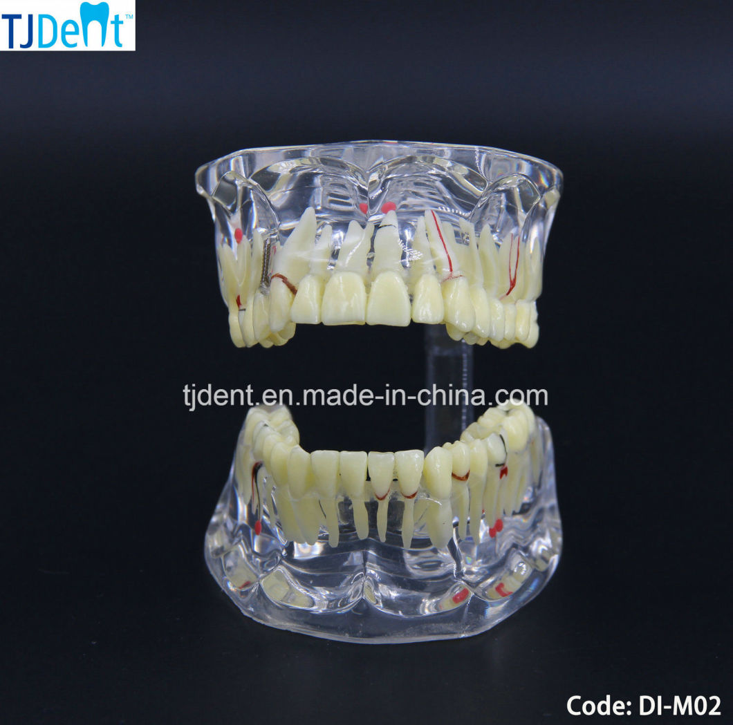 Dental Othodontic Treatment Anatomy Teaching Study Teeth Model (DI-M02)