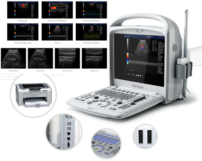 High Accurancy Eco Sonography Color Doppler for Vascular Fetal