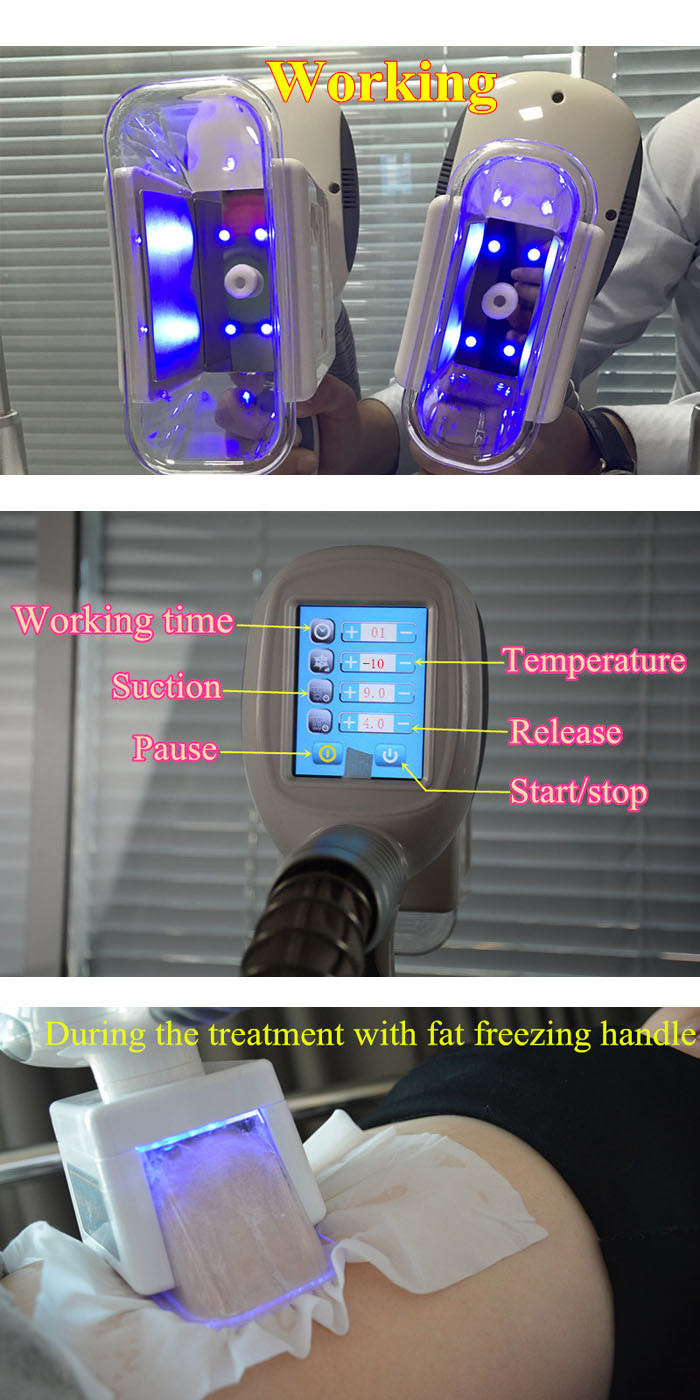 Multifunction Cavitation Ultrasound Vacuum RF Slimming Machine 5 in 1