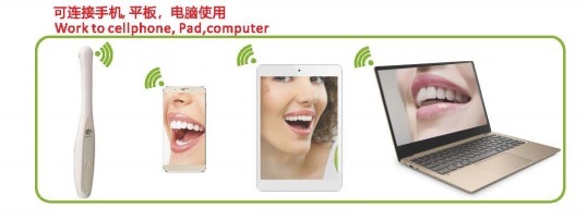 Hot Sale W1000 Wireless WiFi Professional Intraoral Camera