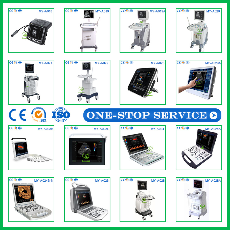 High Quality Medical Ultrasonic Diagnostic Equipment Digital B Ultrasound Machine Price Ultrasound Scanner