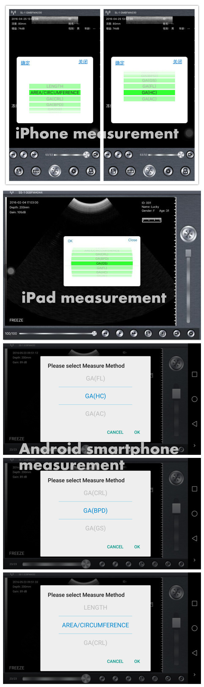 Mobile Sonography WiFi Connected Ultrasound Probe for Smartphone Tablet