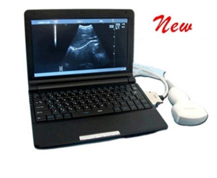 Portable Ultrasound System; Laptop Full Digital Ultrasound Scanner, PT3000d1