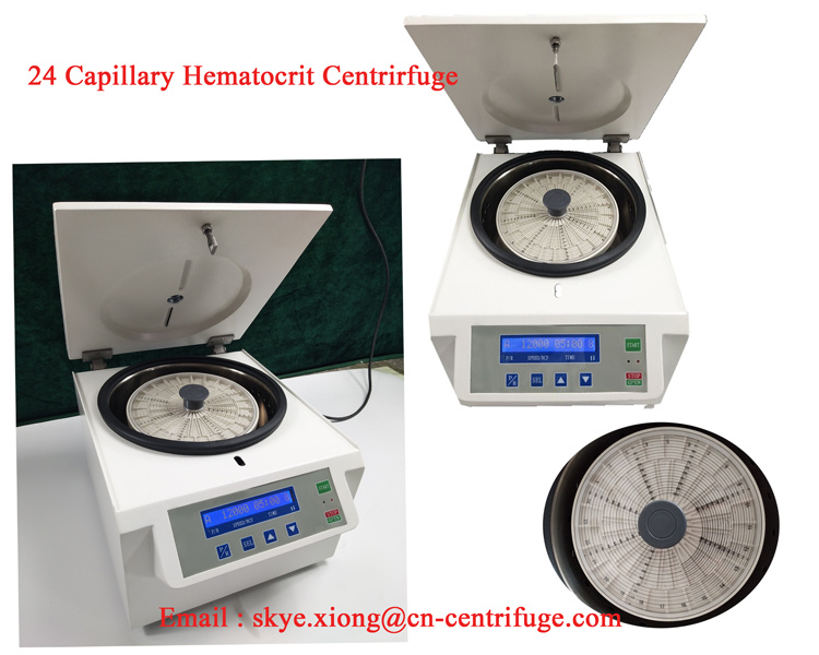 Toption Digital High Speed Blood Separator Hematocrit Centrifuge for Micro Capillary Vessel