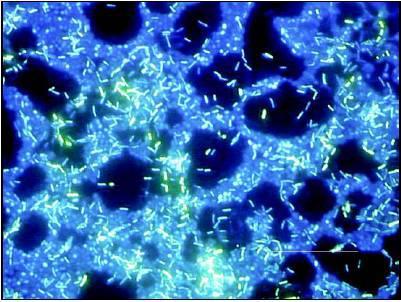 BS-2040F LED Fluorescent Biological Microscope