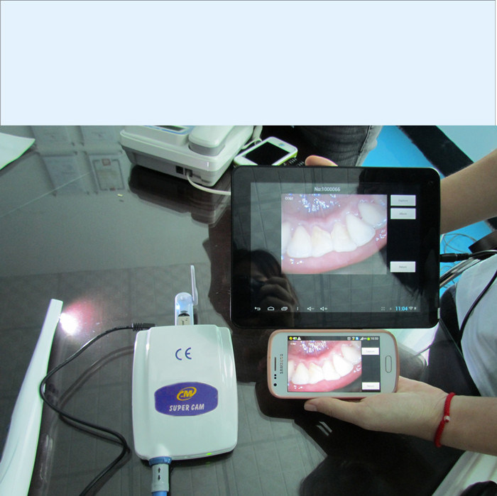 Sony CCD High Resolution Dental Intra Oral Camera
