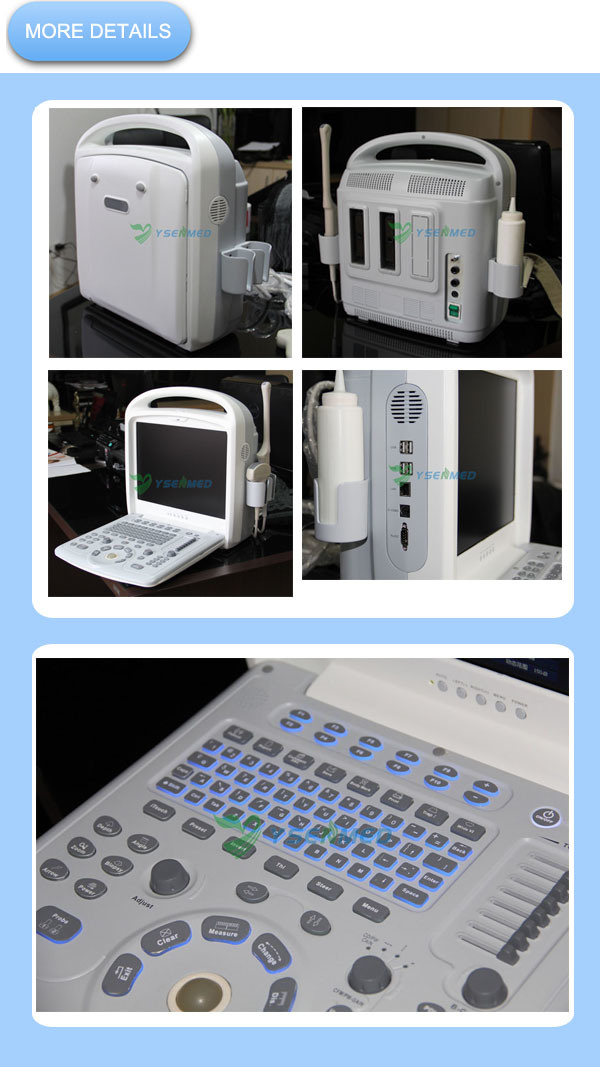 Medical Ysb-V3 Doppler Ultrasound Machine Portable