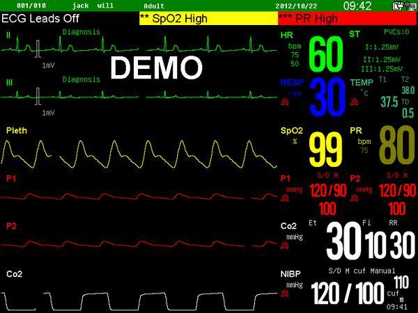 Factory Price Cheap 6 Multi-Parameters Patient Monitor/12 Inch Patient Monitor Price (MSLMP15)