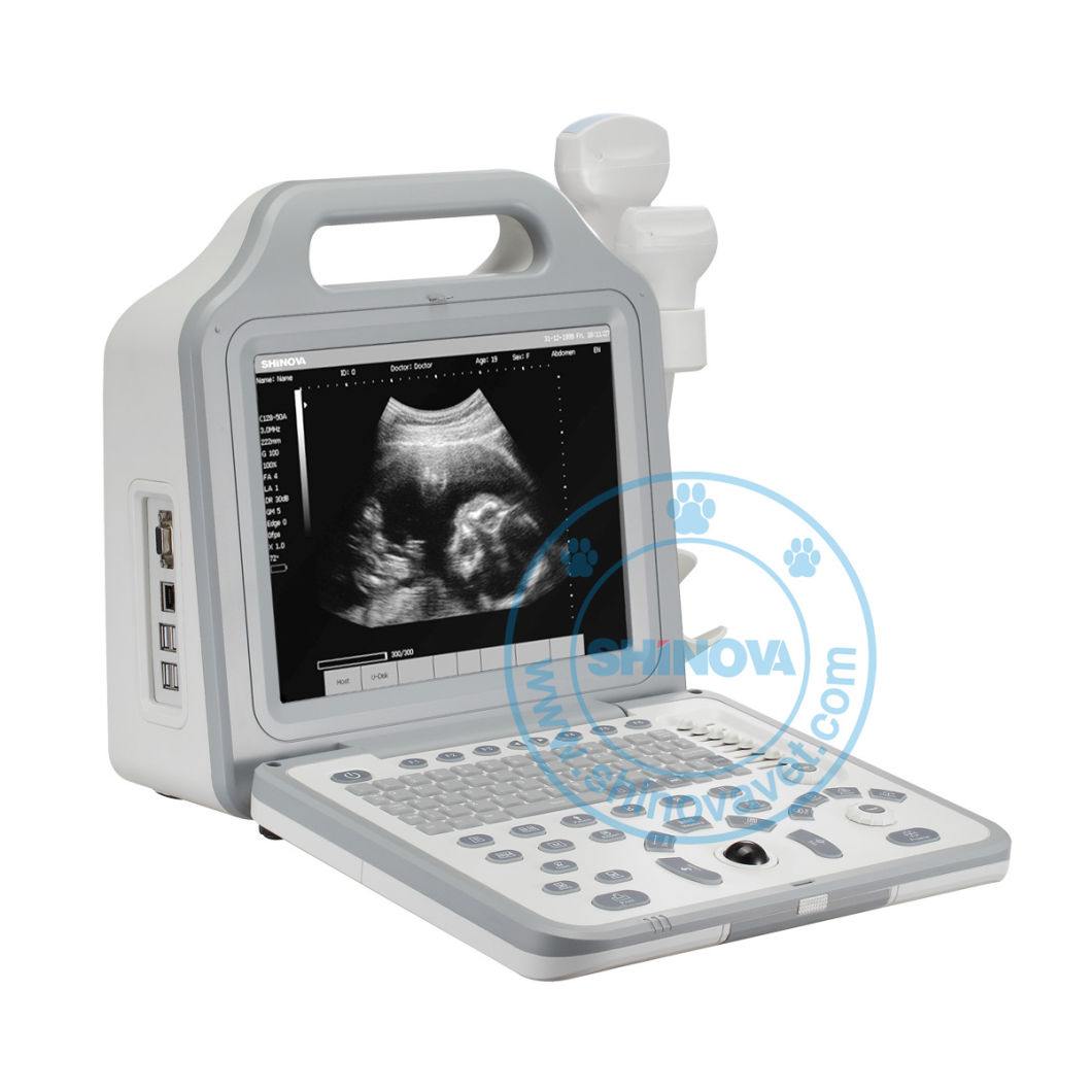 Portable Full Digital Ultrasound System (SonoScan R2V)