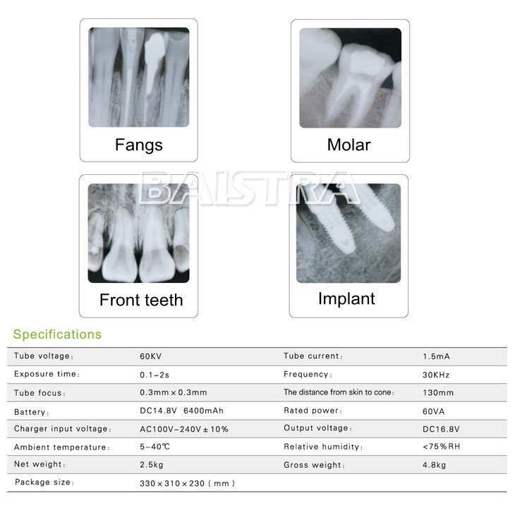 Portable Dental Digital X-ray Machine Unit