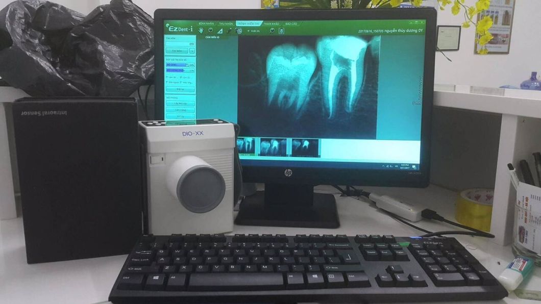 Prox Korea Digital Portable Dental X Ray Unit