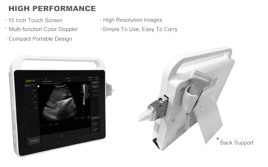 Hospital Equipment Portable Ultrasound 3D Baby Ultrasound