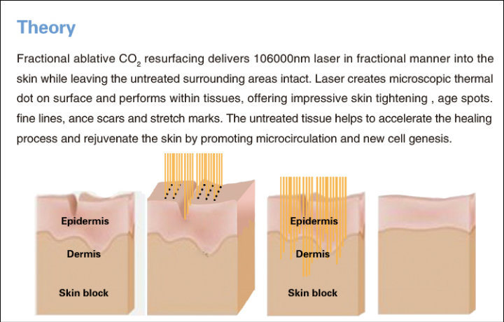 Fractional CO2 Laser Glass Tube Multi Function Asthetic Equipment