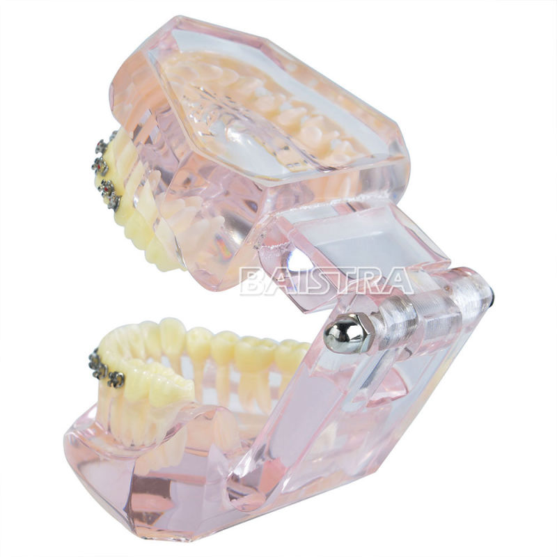 China Supply Most Popular Ceramic Bracket Dental Model