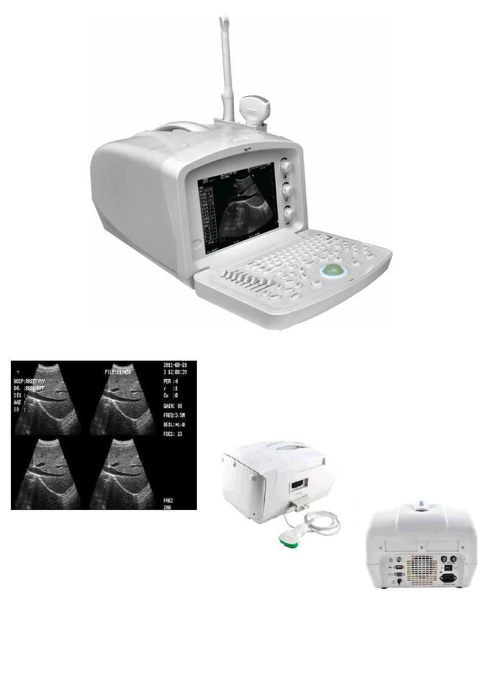 B Model Ultrasound Scanner with High Quality (QDMH-MQ-001A)