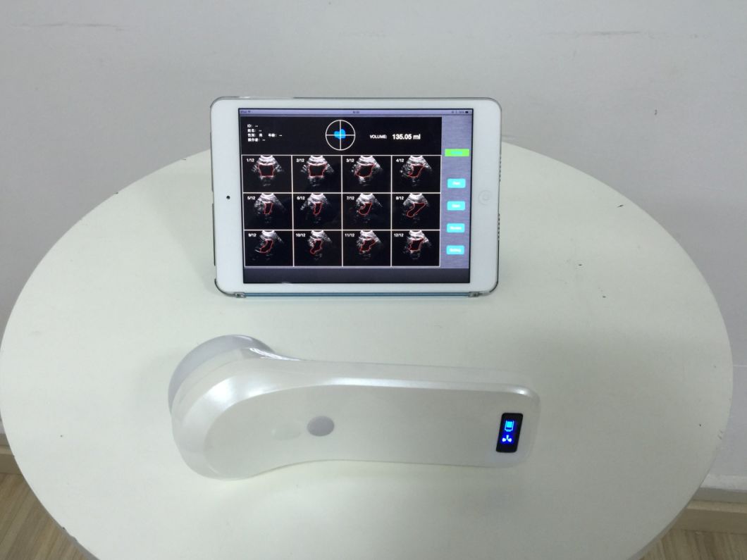 2018 New Developed 4D Wireless Ultrasound Machine Bladder Probe Mslpu37