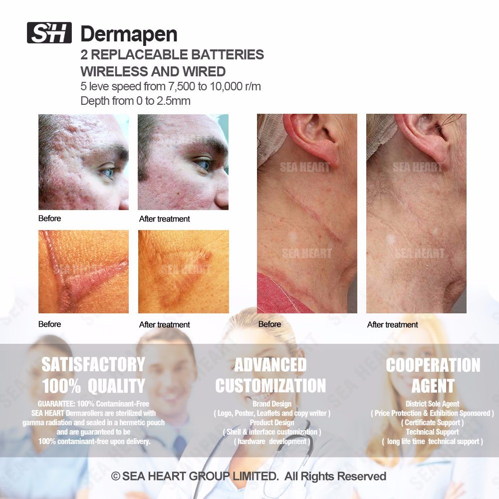 Sea Heart Electric Dr Pen Dermapen for Scar Removal