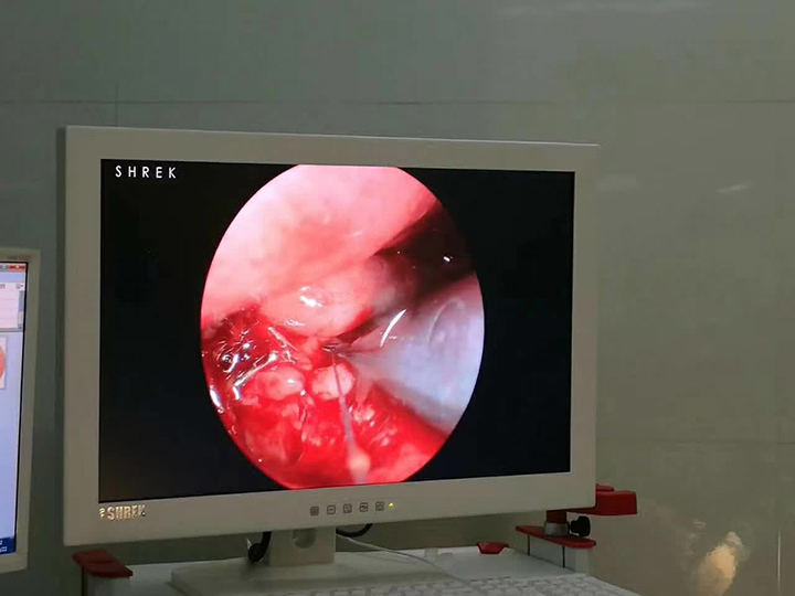 ISO13485 Medical Cold LED Light Source From China