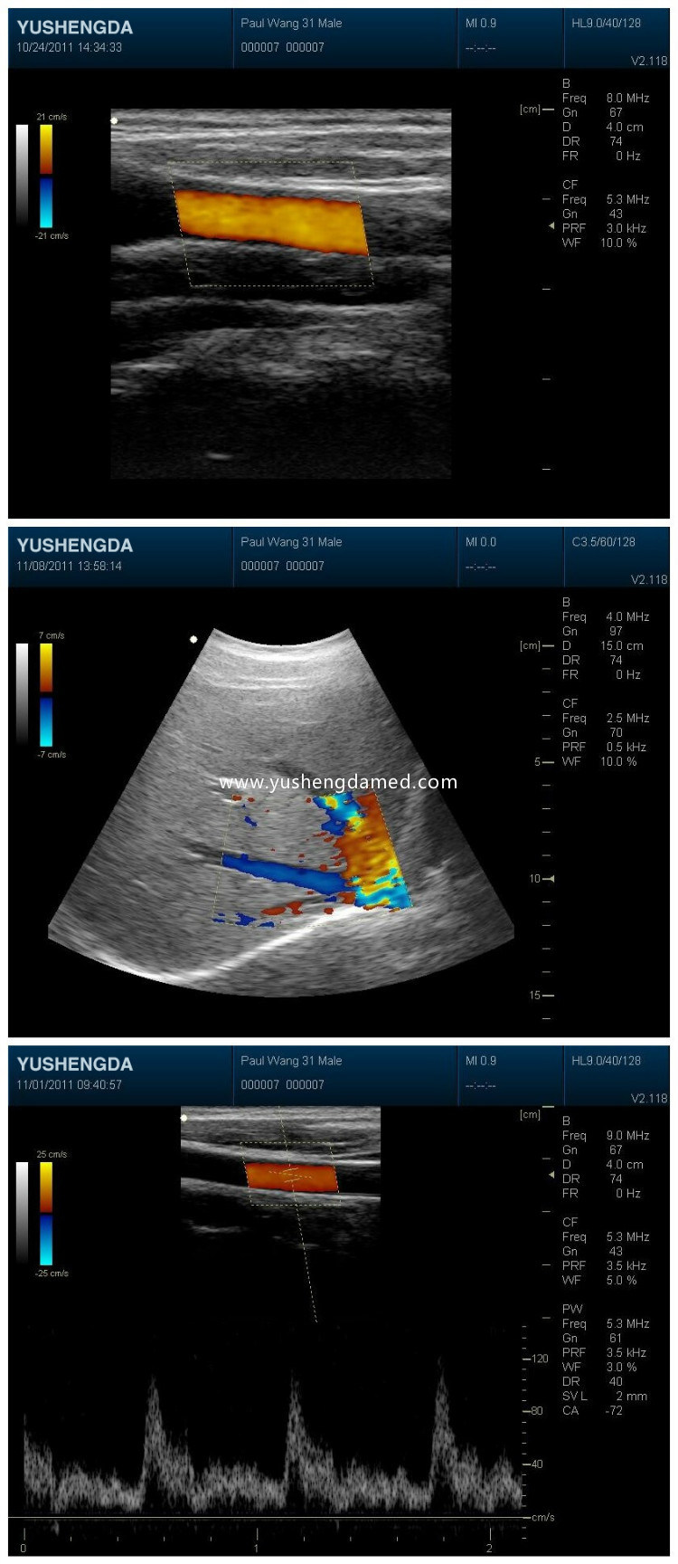 Cheapest 3D Color Doppler Medical Diagnostic Ultrasound