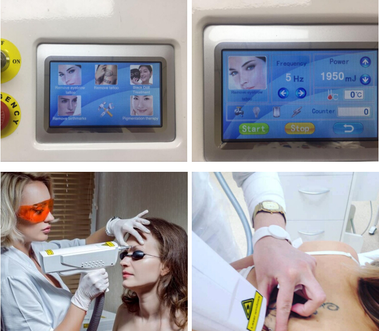 Portable 1064nm 532nm Laser Tattoo Removal Machine with Ce Approved