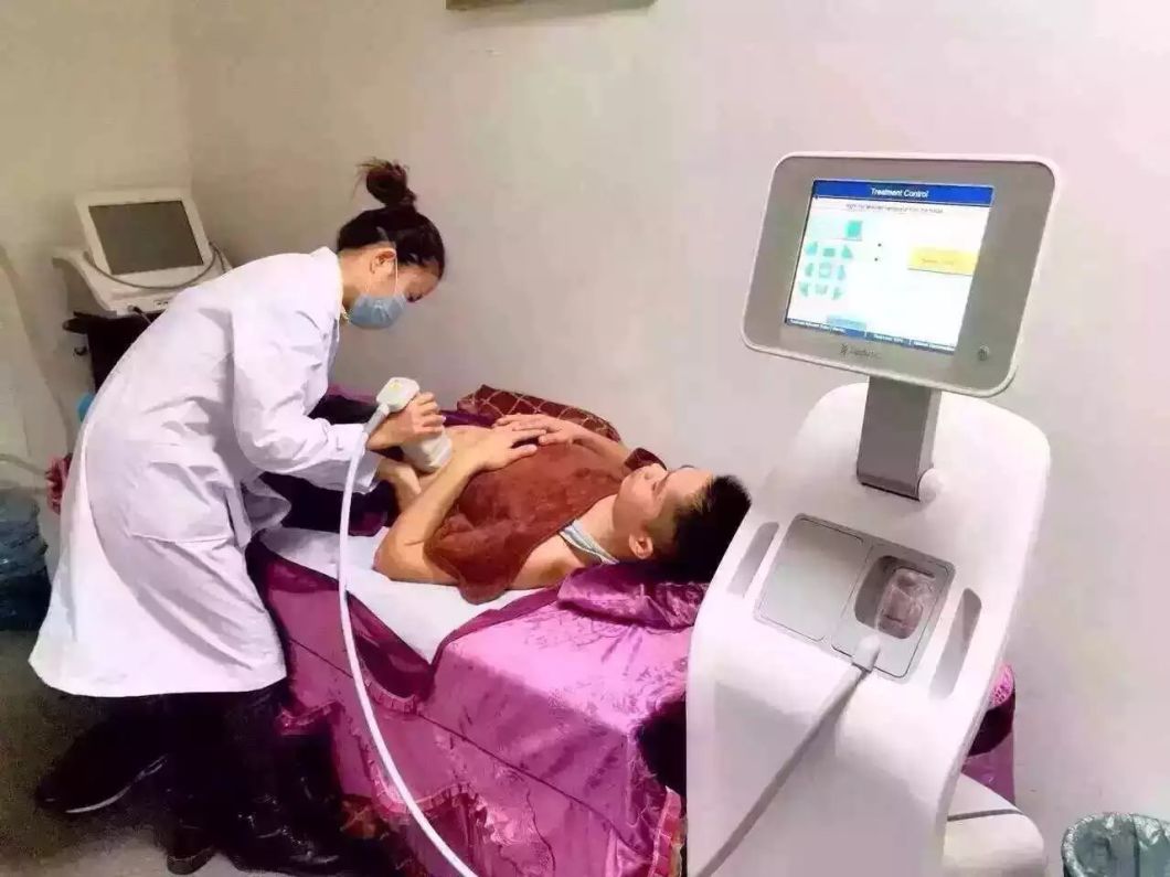 Non-Invasive Focused Ultrasound Hifu Technology Liposonix