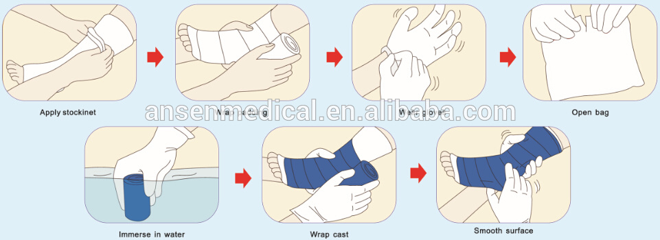 Medical First-Aid Surgical Fiberglass Casting Tape