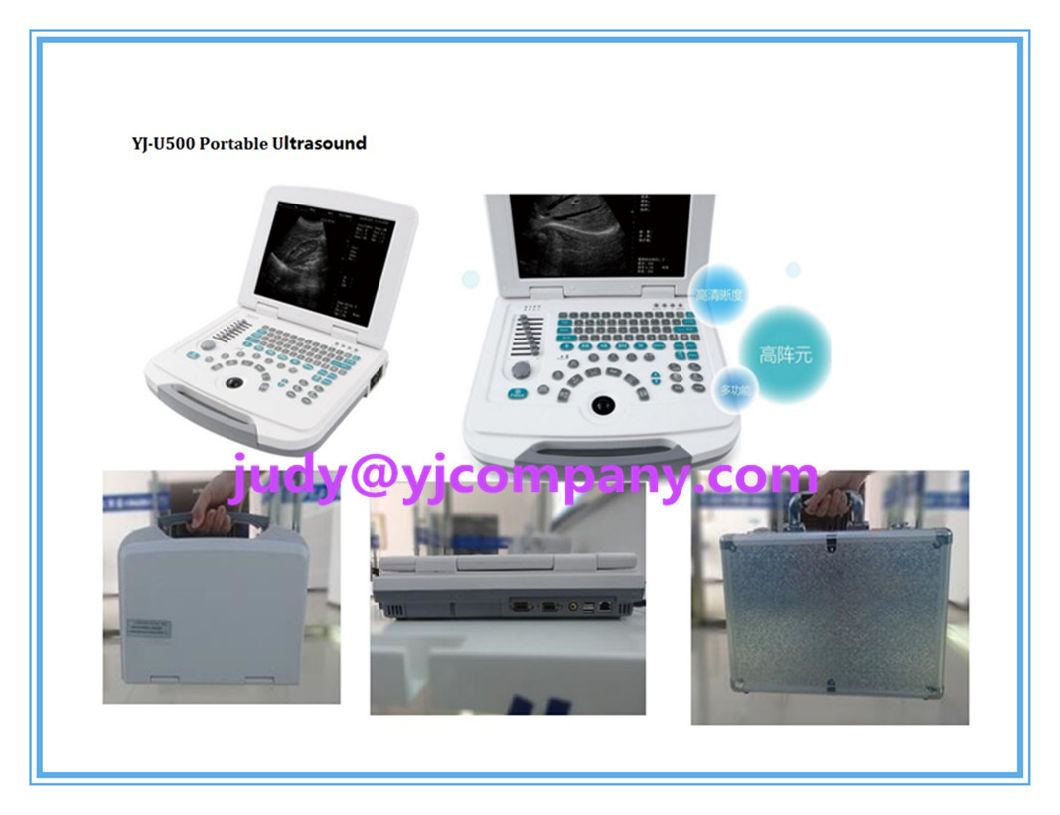 Portable Ultrasonography Machine Ultrasound Scanner