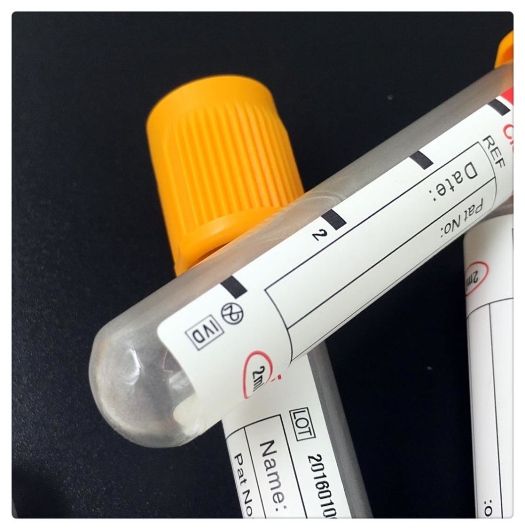 Ce Approved Orange Top PRO-Coagulation Vacuum Blood Collection Tube