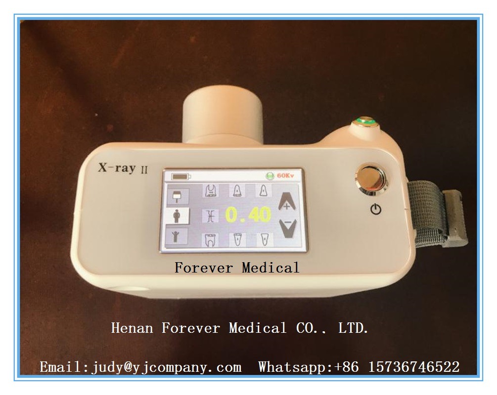 Supply Digital Portable Dental X Ray Camera Machine