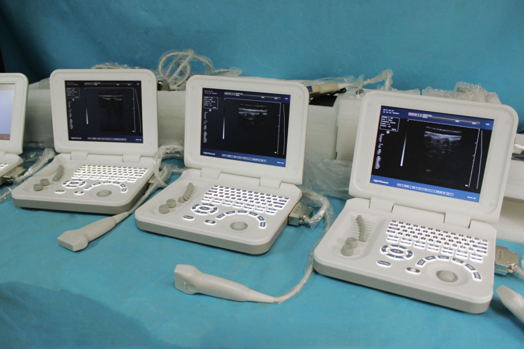 Cheapest Digital Diagnosis Medical Ultrasound Equipment Mslpu26