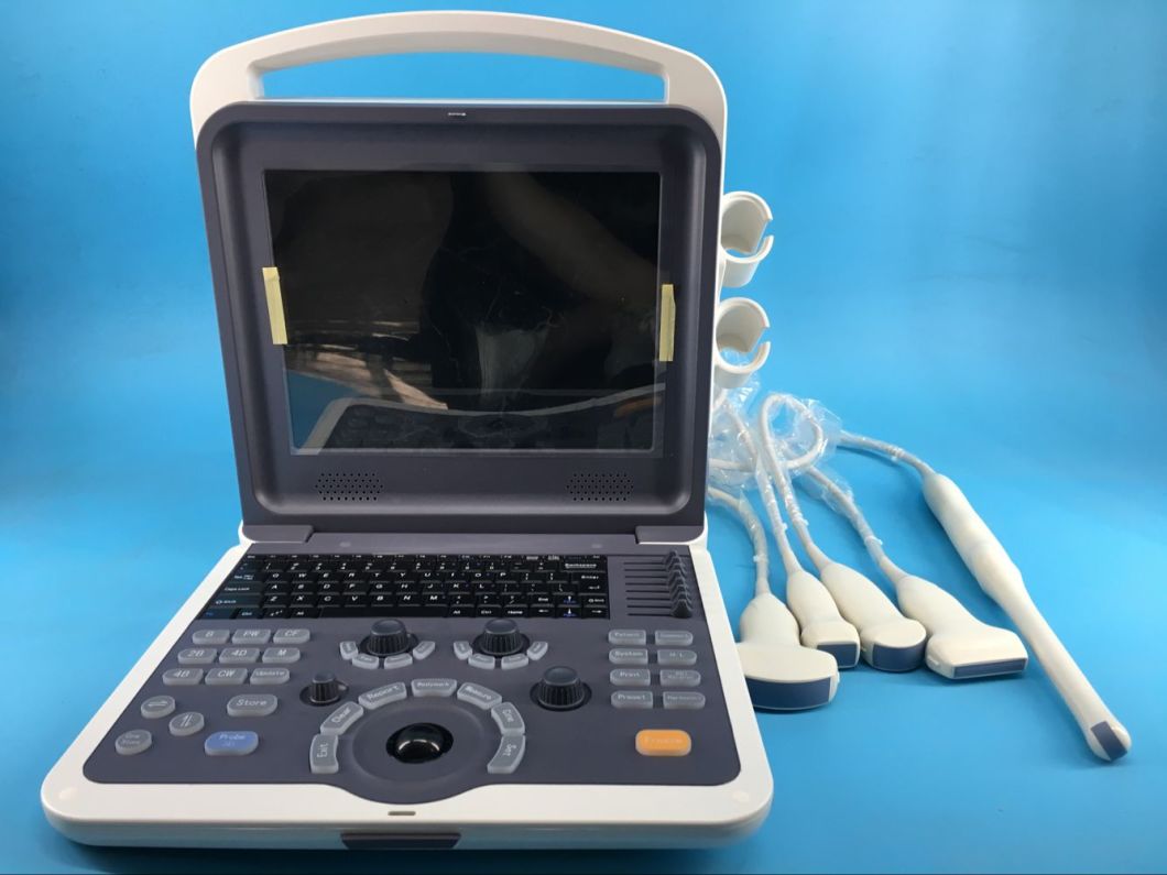 High Accurancy Eco Sonography Color Doppler for Vascular Fetal