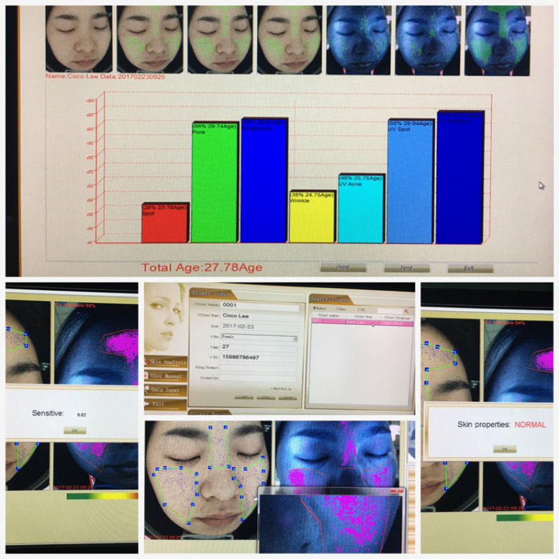 Face Lifting Skin Analysis Skin Care Treatment Machine